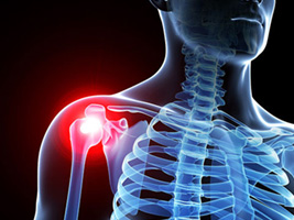 首肩腕の不調 イメージ